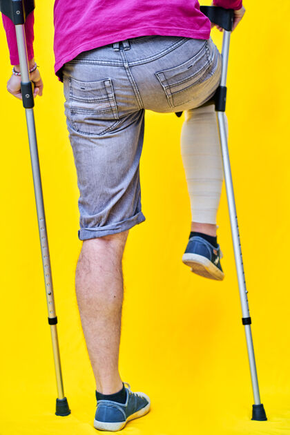 创伤用紫色t恤短裤和拐杖从后面把一个男人的腿收起来 一条腿缠着绷带 拄着拐杖休息塑料站拐杖