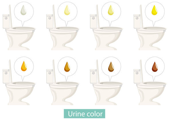正常一套不同尿液颜色的马桶彩色厕所尿液