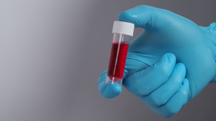 试管血圆管19测试医生手拿血样管在实验室进行分析技术员戴着医用手套拿着血样管进行研究保健化学疾病