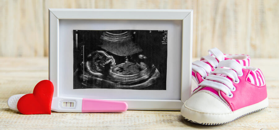 怀孕宝宝的超声波照片和配件产妇胎儿技术