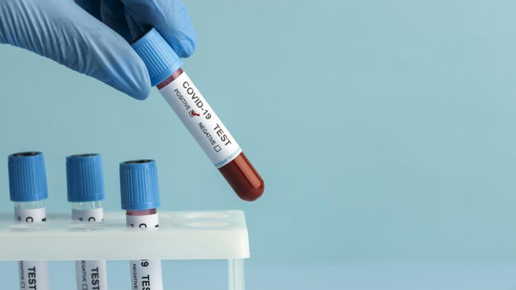实验室手上戴着防护手套 拿着血样做covid检测血液测试医疗健康